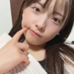 元STU48黒岩唯が全身脱毛症を公表「まゆ毛、まつげ、頭髪などすべての毛がなくなりました。」