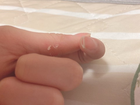 【SKE48】中坂美祐「人差し指の爪が折れちゃったんです」