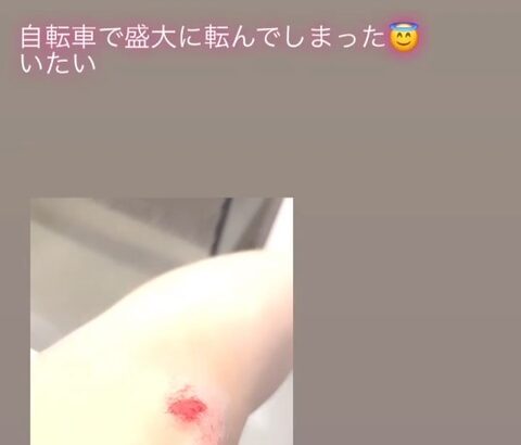 【SKE48】水野愛理が自転車で盛大に転けて大怪我をする…