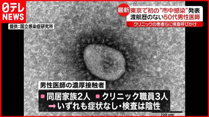 【オミクロン株】東京で“市中感染” 渡航歴のない50代男性医師　新型コロナウイルス