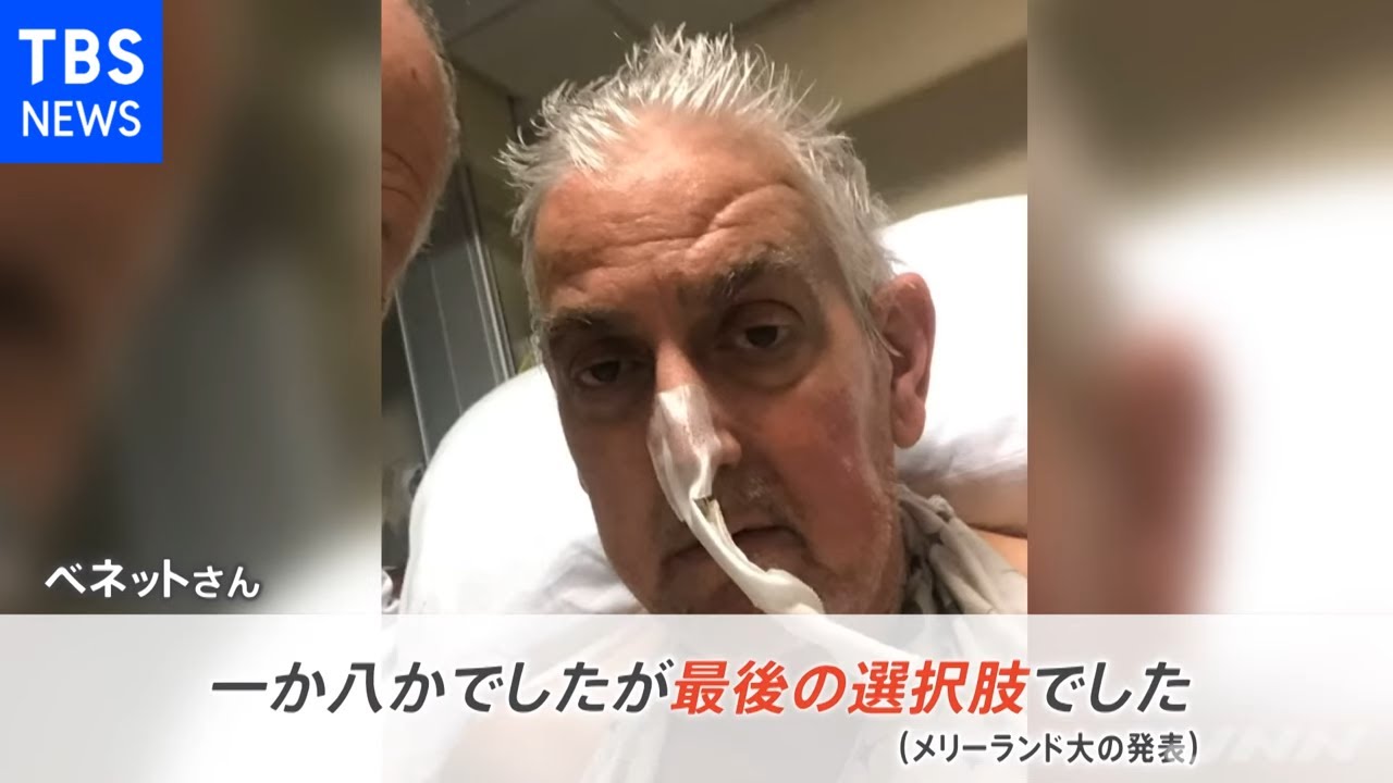 遺伝子操作されたブタの心臓を人に移植 米大学で“世界初”