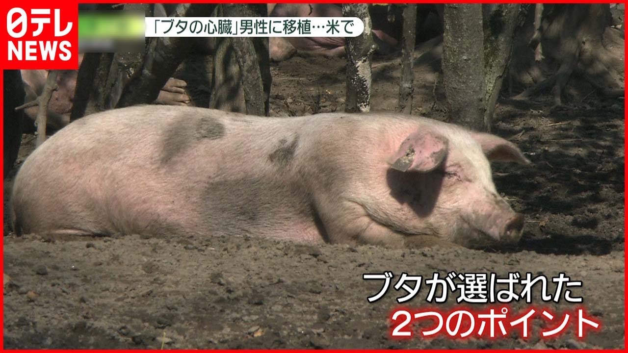 【世界初】アメリカでブタの心臓“移植” 心臓病患う子の母は