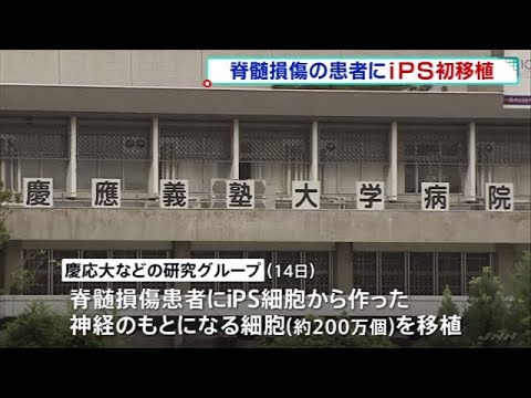 世界初 慶大などが脊髄損傷の治療にｉＰＳ由来の細胞を移植