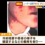 国内未承認『脂肪溶かすレーザー治療』で女性大やけど…美容クリニック医師ら書類送検（2022年1月27日）