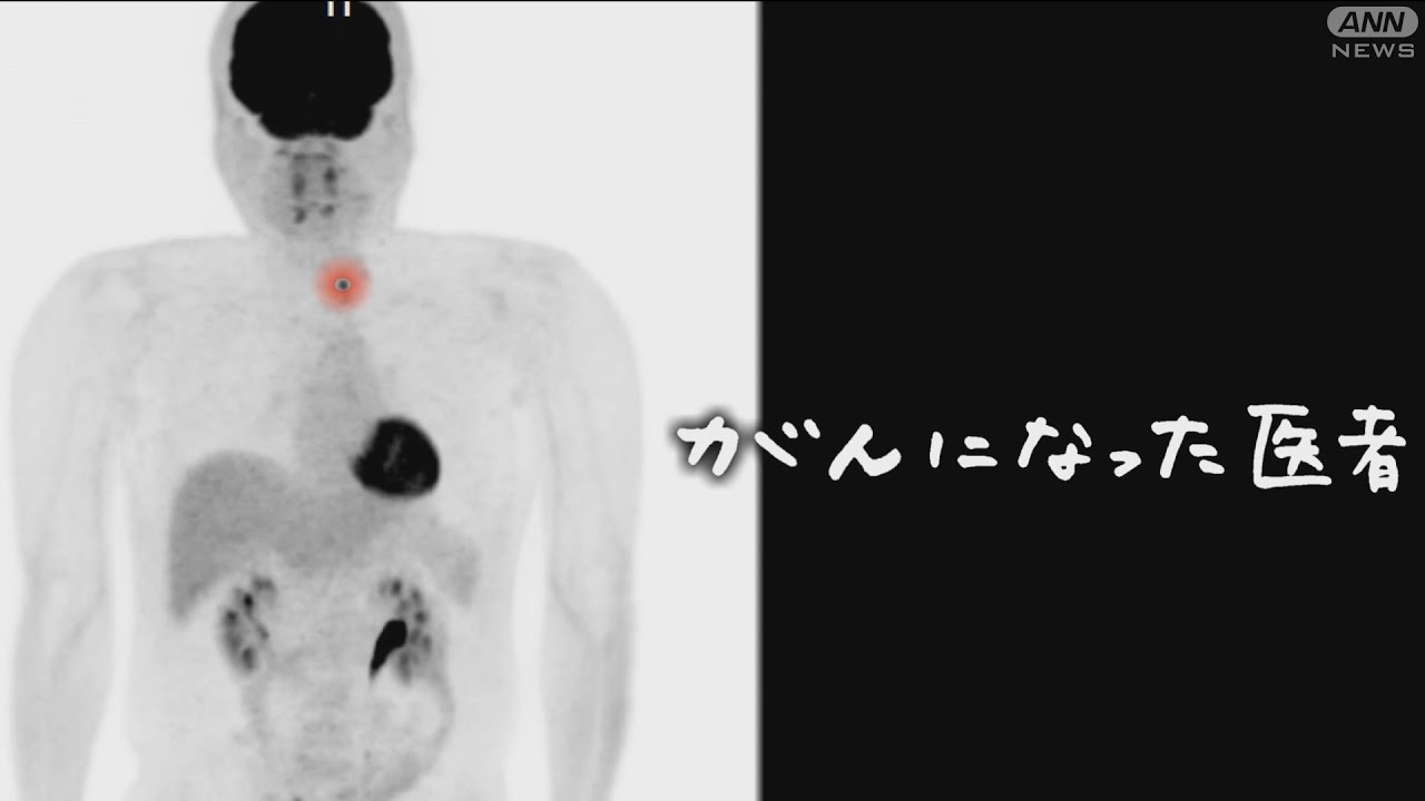 がんになった医者～がん専門医 焦りと苦悩の闘病記【テレメンタリー2022】【abn 長野朝日放送】