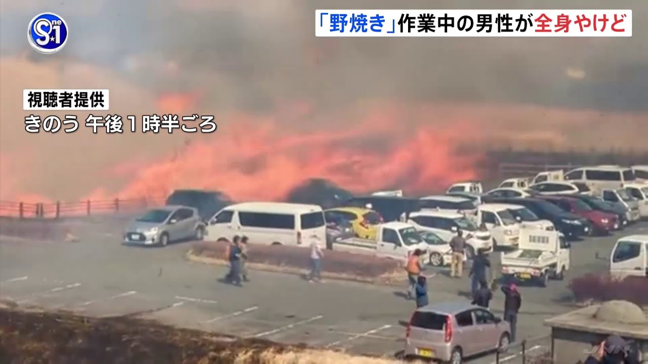 「野焼き」作業中の男性が全身にやけど 熊本県阿蘇市