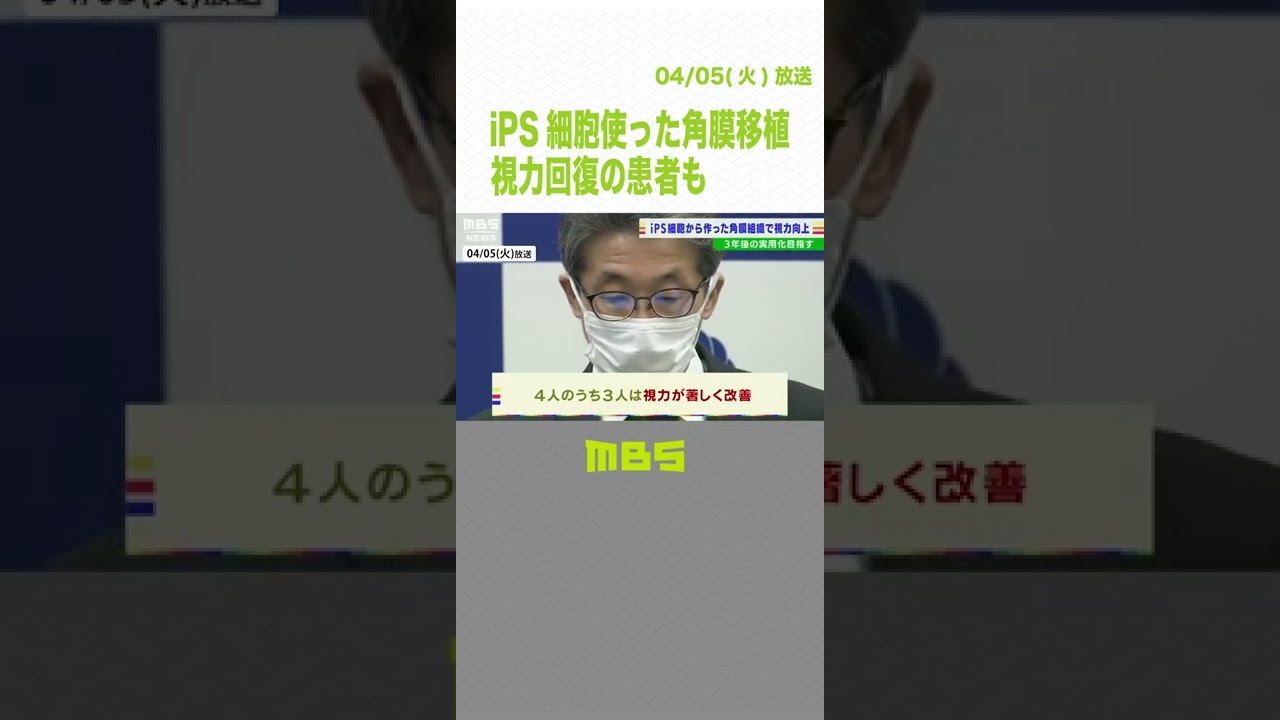 【視力回復の患者も】『ｉＰＳ細胞から作製の角膜組織』を移植する手術成功し安全性を確認　世界初の臨床研究　大阪大学(2022年4月5日) #Shorts #ips細胞