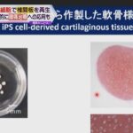 大阪大　ｉＰＳ細胞で椎間板再生実験に成功　腰痛に悩む人に朗報か　３年後に臨床研究目指す