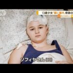 13歳少女　奇跡の生還・・・ロシア軍砲撃で“頭に破片”(2022年4月22日)