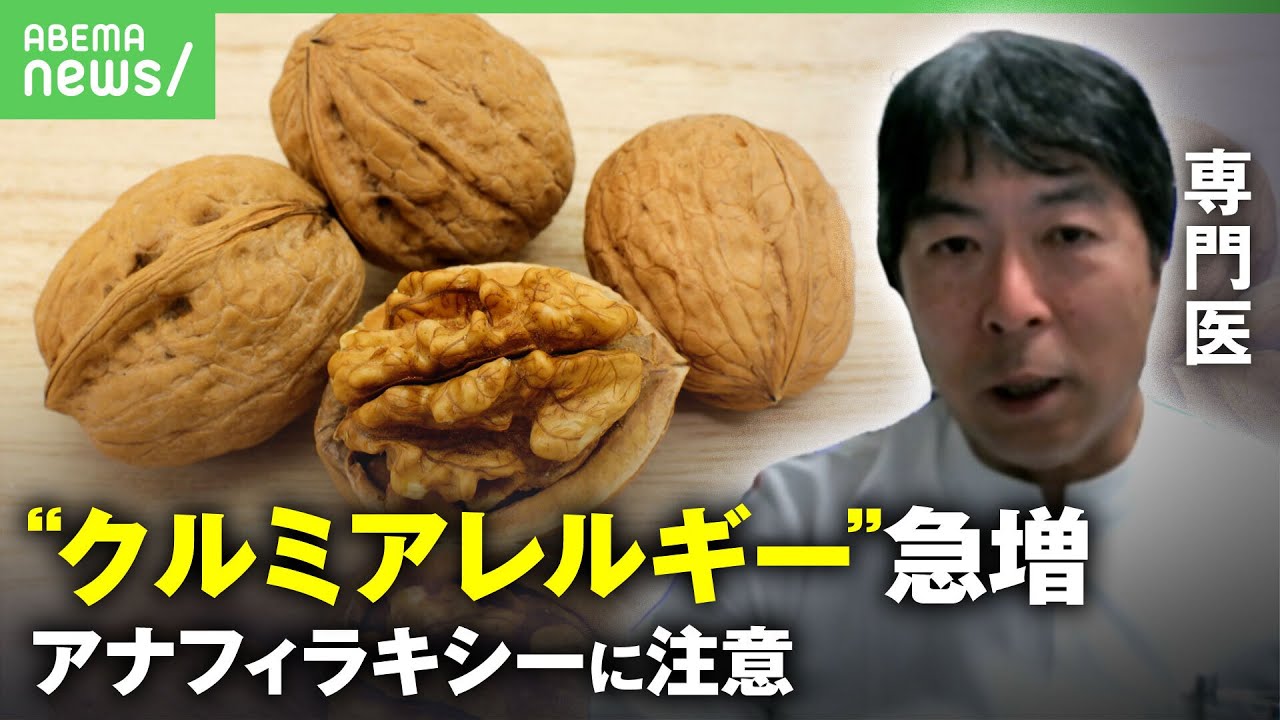【10倍】“クルミアレルギー”急増 アナフィラキシーショックで搬送も…原因と対策｜#アベヒル《アベマで放送中》