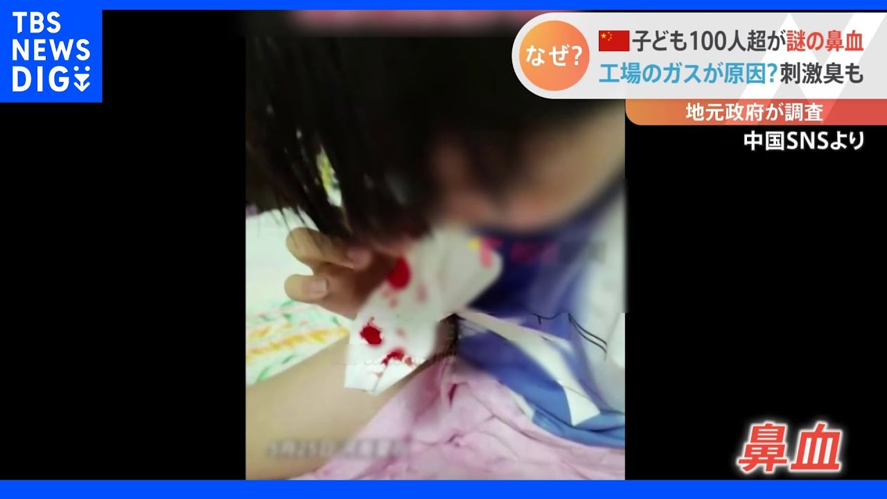 子ども100人超が謎の鼻血&nbsp;工場のガスが原因？刺激臭も&nbsp;地元政府が調査&nbsp;中国・河南省｜TBS&nbsp;NEWS&nbsp;DIG
