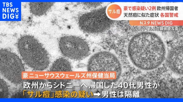 天然痘に似た症状の「サル痘」オーストラリアでも感染疑い例報告｜TBS NEWS DIG