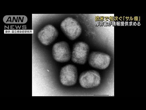 欧米で相次ぐ「サル痘」　“疑い”患者の情報提供を(2022年5月23日)