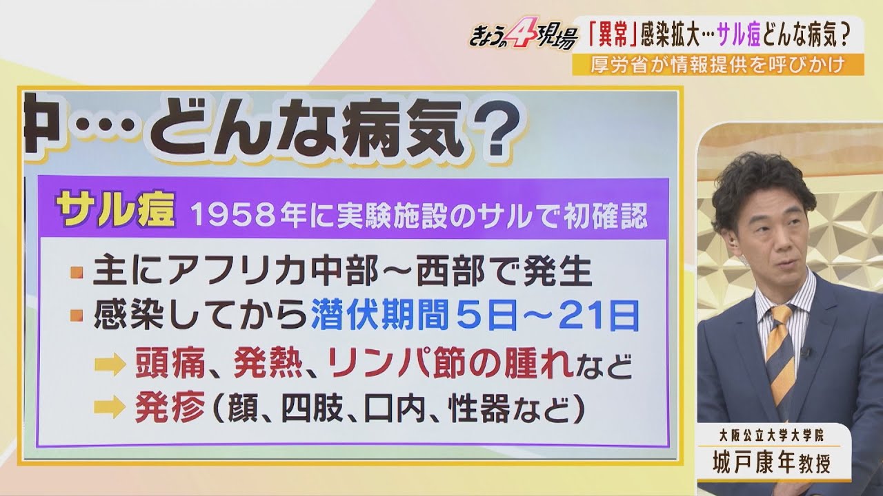 【専門家解説】”全身に発疹が出る”感染症『サル痘』国内では報告ないが…感染力や危険性について感染症学の研究者に聞く（2022年5月24日）