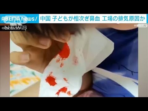 中国　多数の子どもが相次ぎ鼻血　工場の排気が原因か(2022年5月26日)