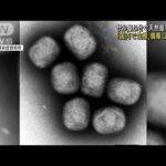 “サル痘”ふせぐ天然痘ワクチン「国内で生産備蓄」(2022年5月27日)