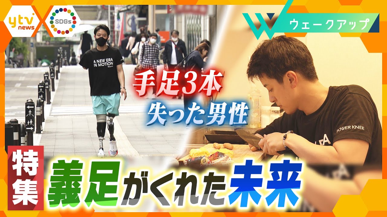 【挑戦】“左手一本”で生きる 義足とともに“歩む” 未来をひらく最新AI技術とは…