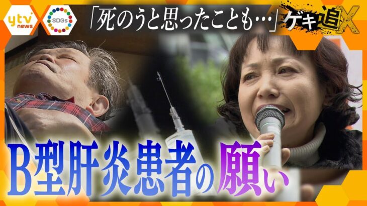 “治らない病気”B型肝炎、一生続く治療にガンの発症も…医療の進歩願う患者と研究者たちの闘い