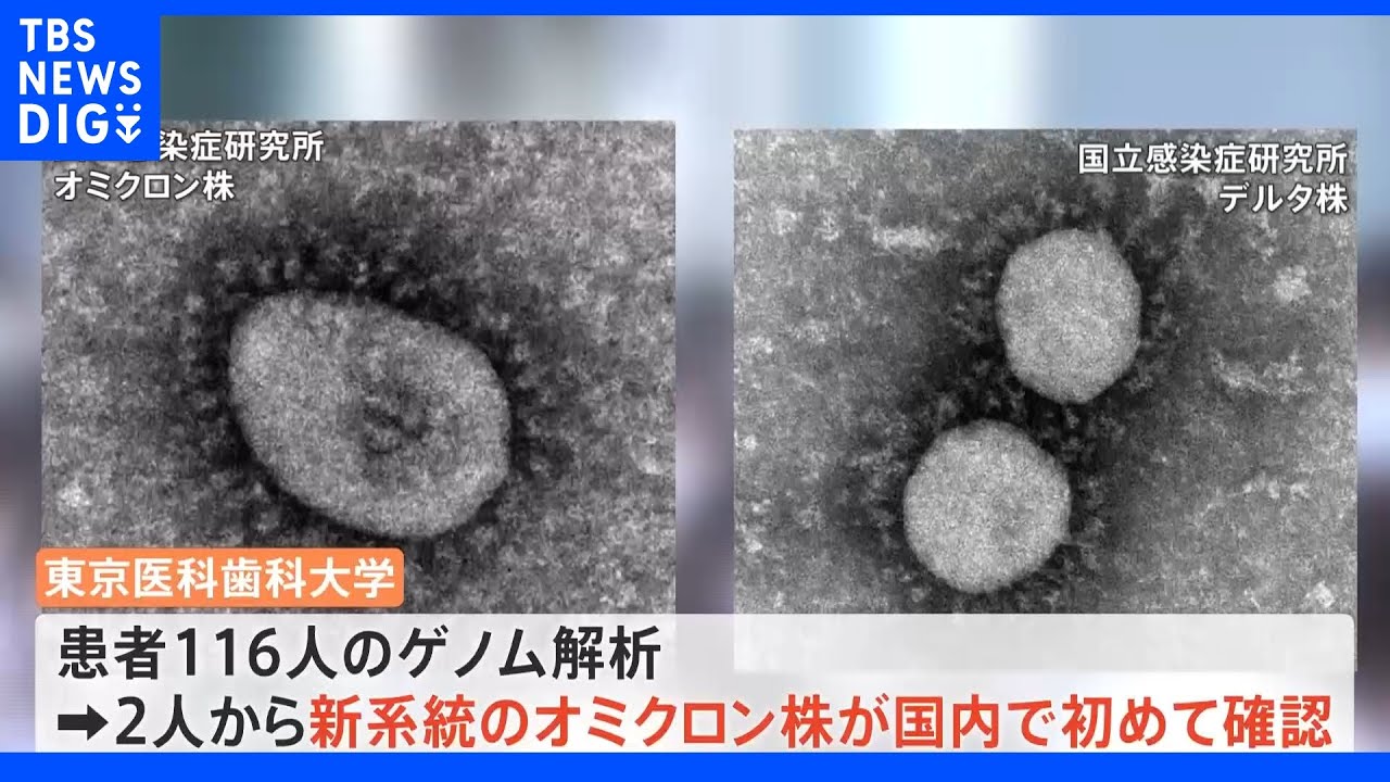 国内初確認　デルタ株の特徴が追加されたBA.2系統の市中感染｜TBS&nbsp;NEWS&nbsp;DIG