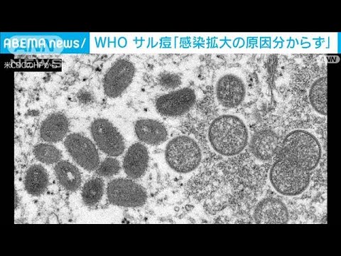 WHO　サル痘「感染拡大の原因分からず」(2022年5月28日)