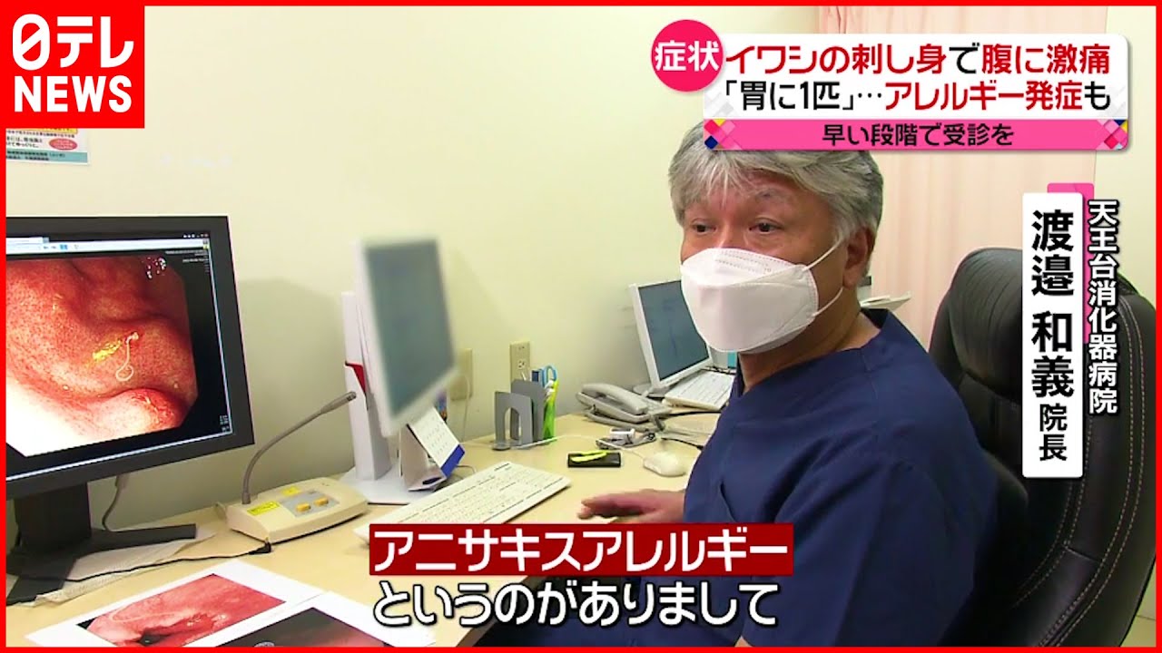 【注意】「アニサキス」食中毒相次ぐ　鮮魚店や飲食店は…