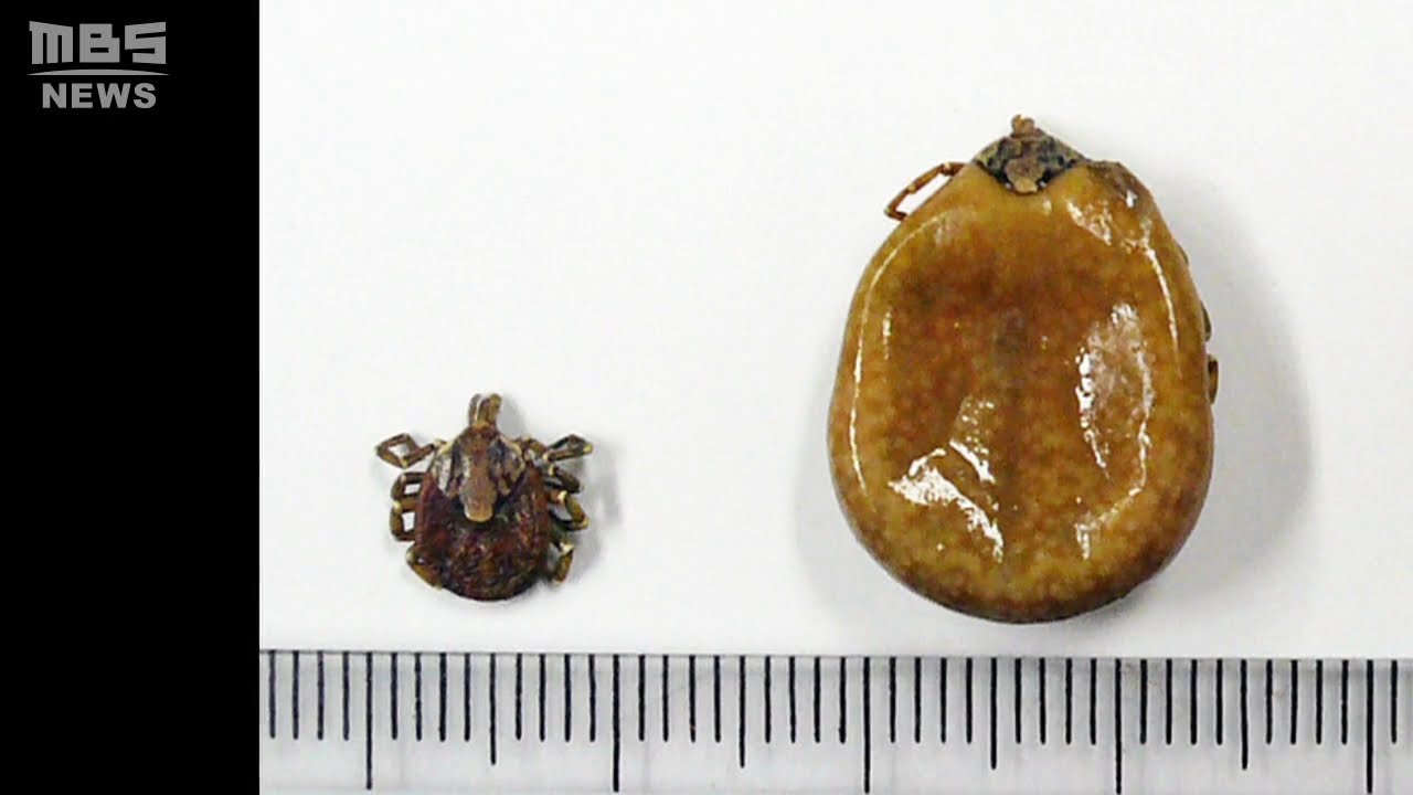 ８０代女性がマダニに刺され入院…感染症「ＳＦＴＳ」と診断　農作業など草むら行き来（2022年6月8日）