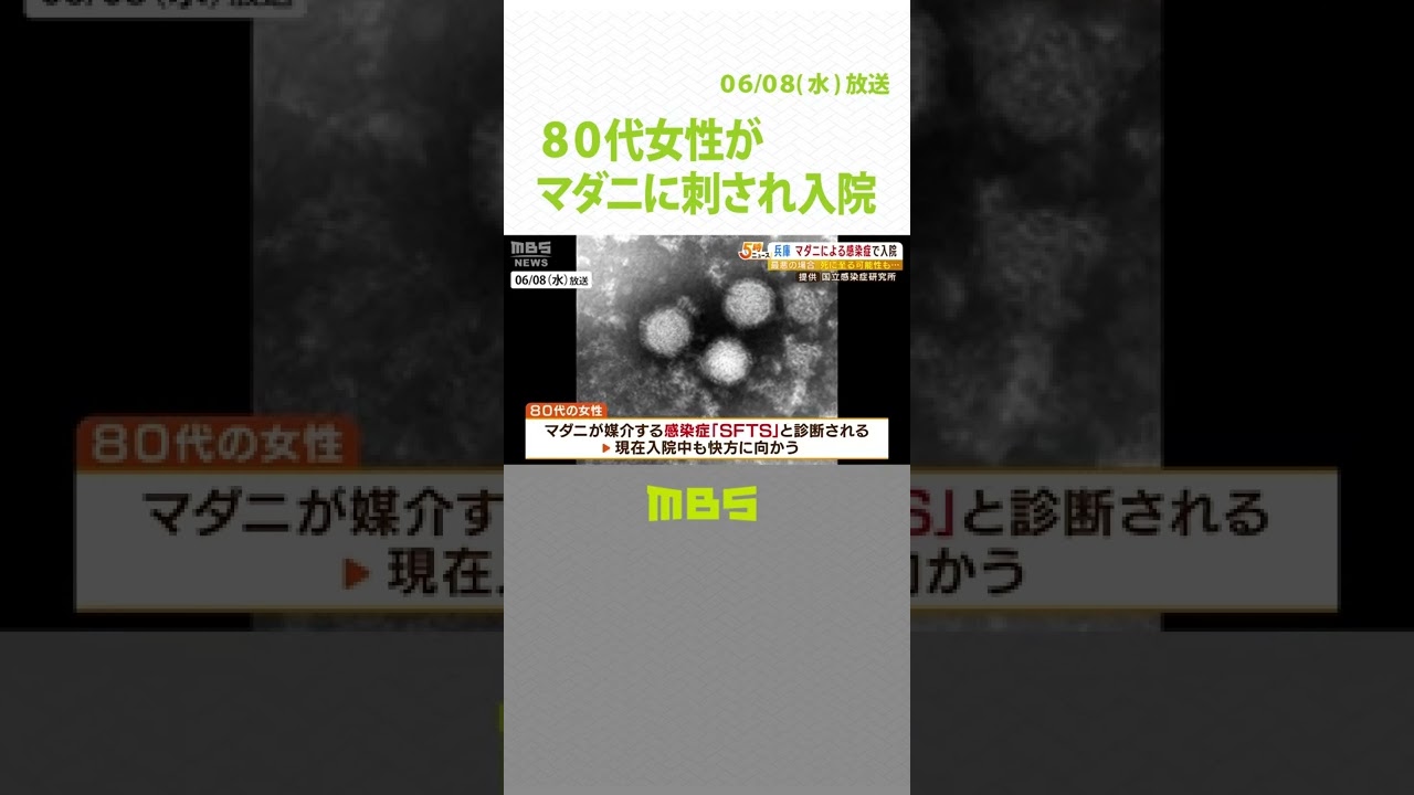 80代女性がマダニに刺され入院…感染症「SFTS」と診断 農作業など草むら行き来(2022年6月8日)#shorts#マダニ#感染症