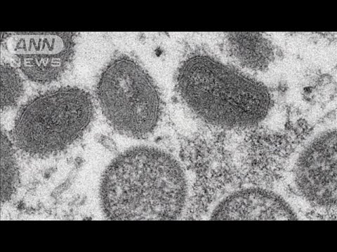 米の首都も・・・サル痘の感染増加　感染経路不明の患者も(2022年6月11日)
