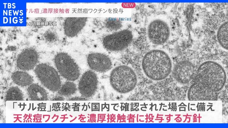 「サル痘」濃厚接触者に「天然痘ワクチン」を投与　国内でも研究開始｜TBS NEWS DIG