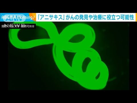 「アニサキス」がんの発見や治療法に役立つ可能性　大阪大学(2022年6月23日)