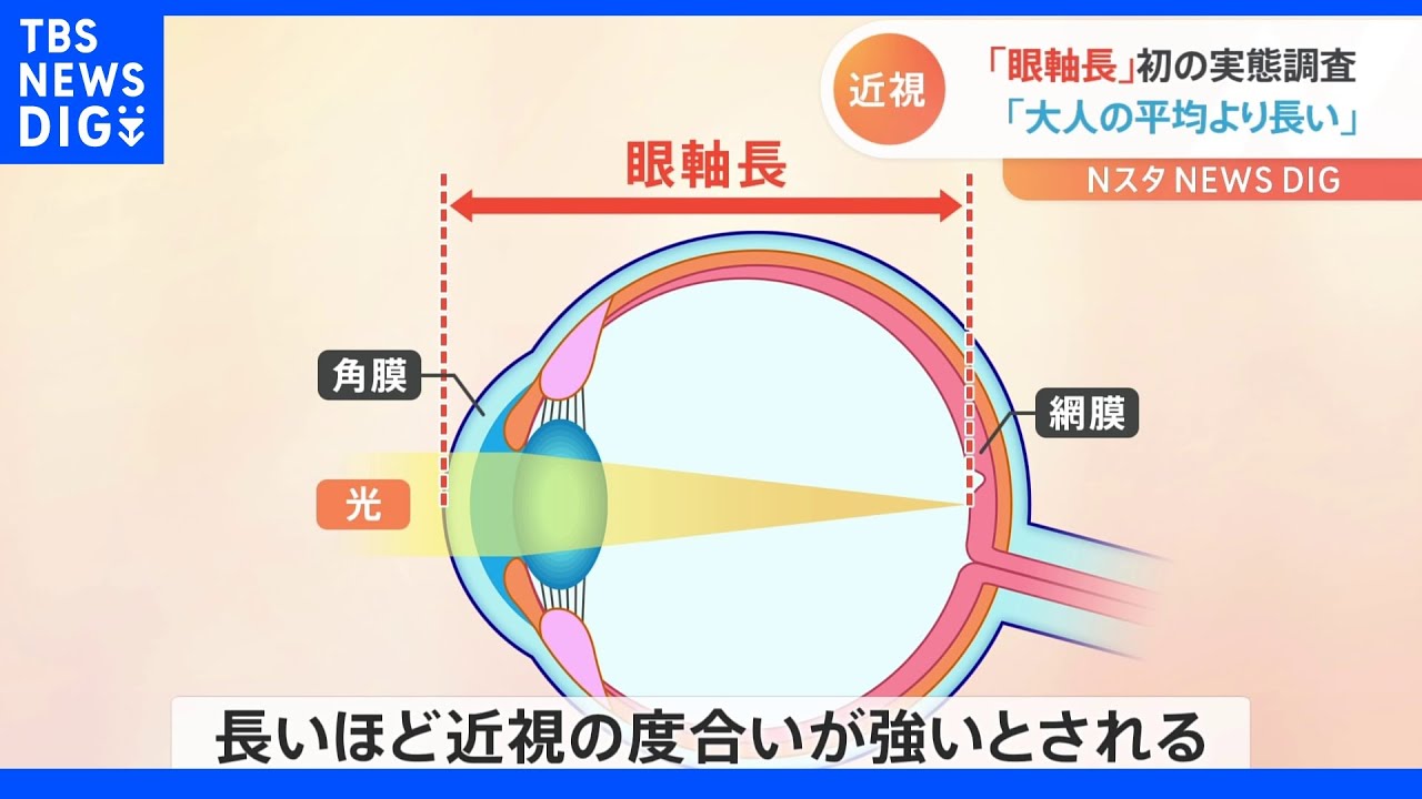 小中学生の近視実態調査　長いほど近視の度合いが強いとされる​「眼軸長」　中学3年生が大人の平均よりも長い｜TBS&nbsp;NEWS&nbsp;DIG