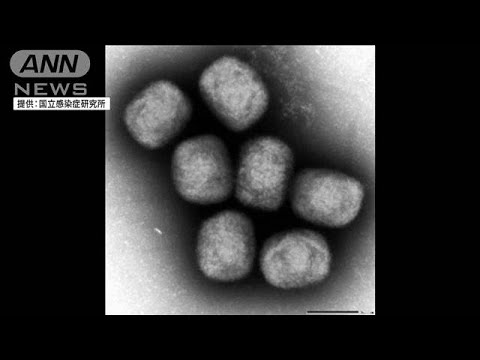 サル痘「初期症状なく感染拡大か」発熱や悪寒見られず(2022年6月24日)