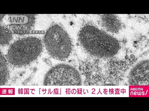 【速報】韓国で「サル痘」初の感染疑い　2人を検査(2022年6月22日)