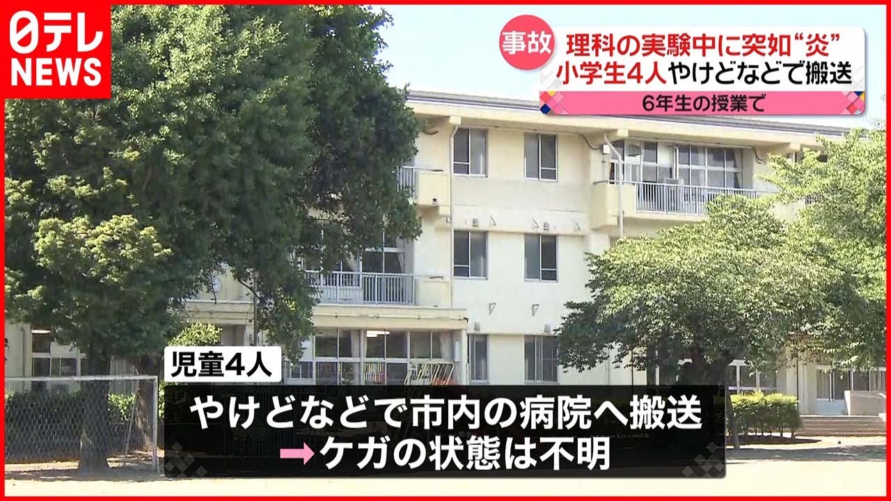 【理科の実験で“炎”】児童4人ケガ 群馬･沼田市の小学校