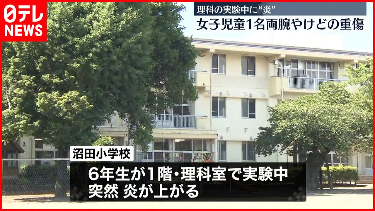 【理科の実験中に“炎”】児童4人搬送…うち1人が両腕にやけどする重傷 群馬・沼田市
