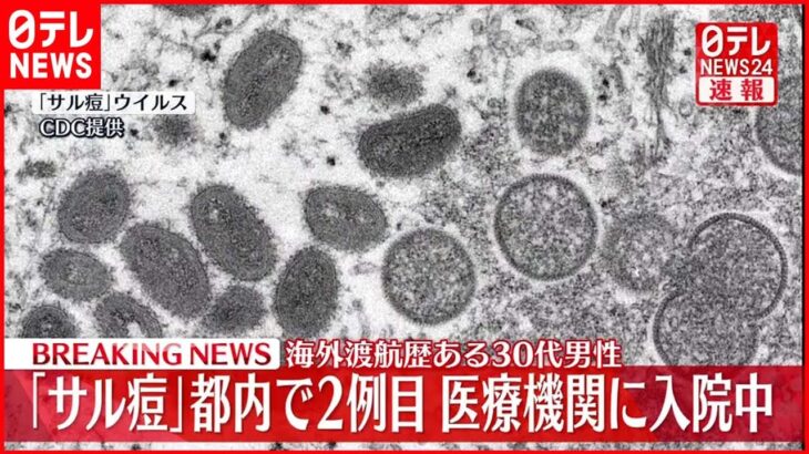 【速報】国内2例目「サル痘」感染者を確認 海外渡航歴のある男性 東京都