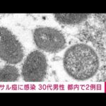 【速報】東京都内で2例目のサル痘患者　海外渡航歴ある30代の男性で入院中(2022年7月28日)