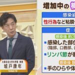 【解説】「梅毒」過去最悪のペースで流行…コロナ禍の非接触時代になぜ？性風俗との関係は？「キスでもうつる可能性ある」(2022年7月13日)