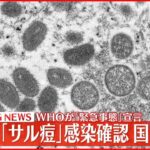【速報】東京都内で「サル痘」感染者を確認 国内初