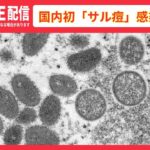 【ライブ】国内初「サル痘」の感染者を確認　厚生労働省コメントなど（2022年7月25日）