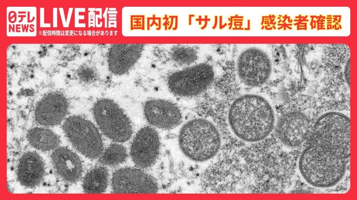 【ライブ】国内初「サル痘」の感染者を確認　厚生労働省コメントなど（2022年7月25日）