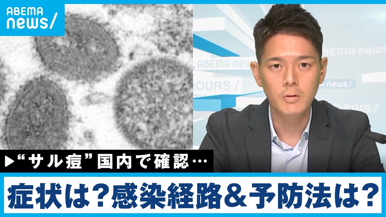 【サル痘】国内でも確認…飛沫感染はする？予防法は？徹底解説｜厚労省担当 松本拓也記者