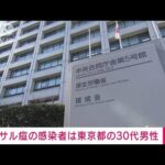 【速報】サル痘感染者を国内初確認　東京都の30代男性(2022年7月25日)