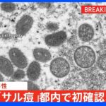 【速報】「サル痘」都内で初確認　30代男性　国内初｜TBS NEWS DIG