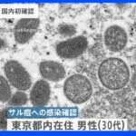 【速報】「サル痘」都内で初確認　30代男性　国内初｜TBS NEWS DIG