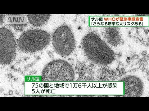 WHO　サル痘で最高レベルの警告「緊急事態」を宣言(2022年7月24日)