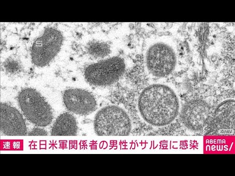 横田飛行場所属の米軍関係者の男性サル痘感染(2022年8月5日)