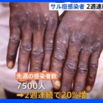 世界のサル痘感染者　2週連続で20%増｜TBS NEWS DIG