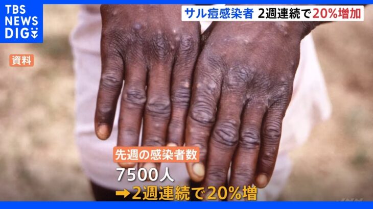 世界のサル痘感染者　2週連続で20%増｜TBS NEWS DIG