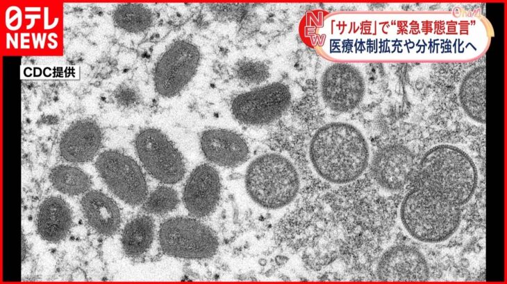 【サル痘】アメリカで「公衆衛生上の緊急事態」宣言